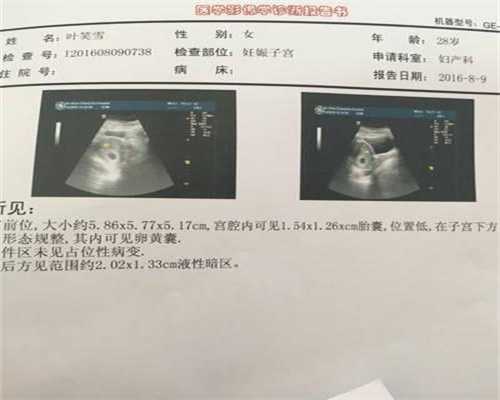 广州代孕全包`做广州试管代孕违不`广州代母与孩子有什么关系