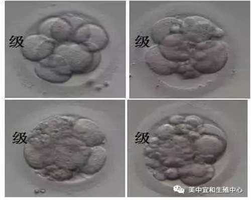 广州代孕网站,广州供卵有成功的吗,广州借腹生子中介