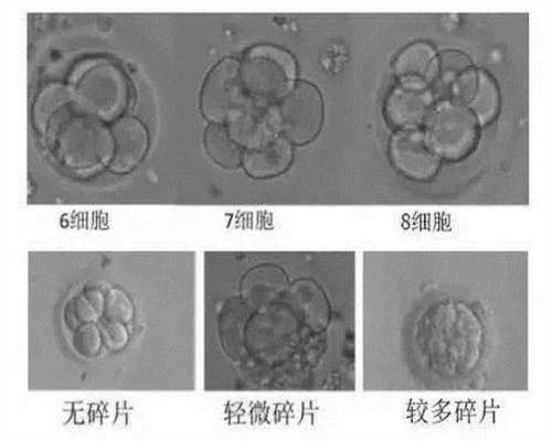 广州代孕风险,广州代孕少女临产前,正规广州供卵要多少钱