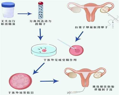 广州代孕婴儿,广州包成功代孕哪家靠谱【广州科学代孕，减少对不孕女性的伤