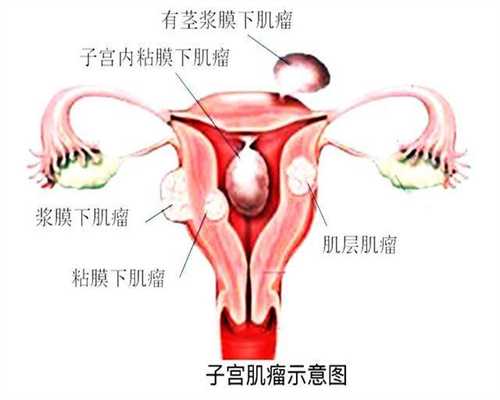 代孕网-代孕网价格-代孕12周胎儿有多大