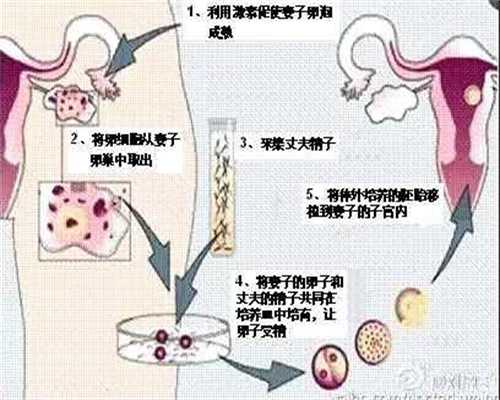 广州大学孕宝:卵巢切除找代怀孕_代怀孕网站